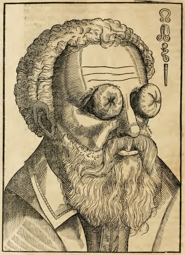bartisch-1583-eyesbackinhead.jpg
